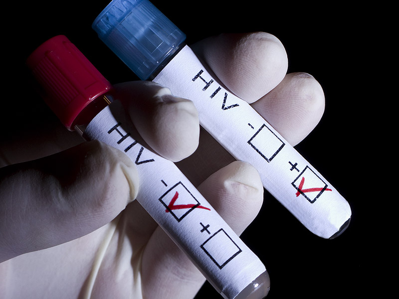 HIV1.jpg